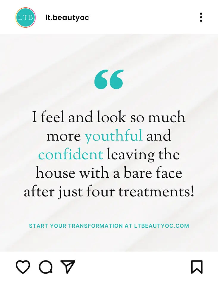 Beauty transformation testimonial after four treatments.